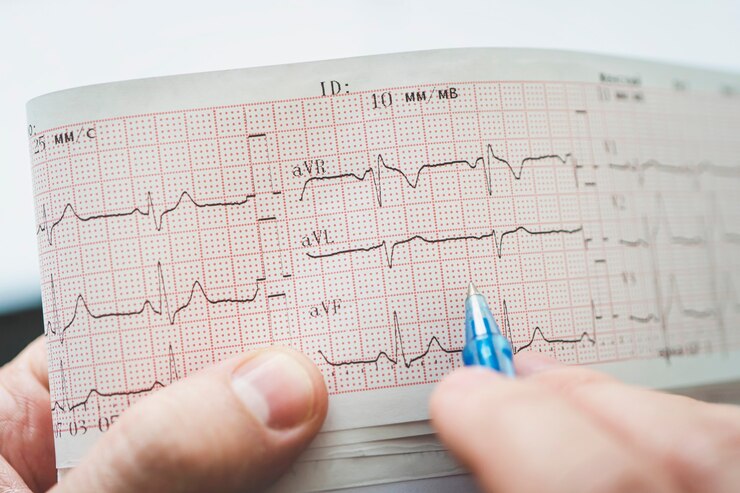 Who Should Get an ECG and Why? Understanding Its Importance